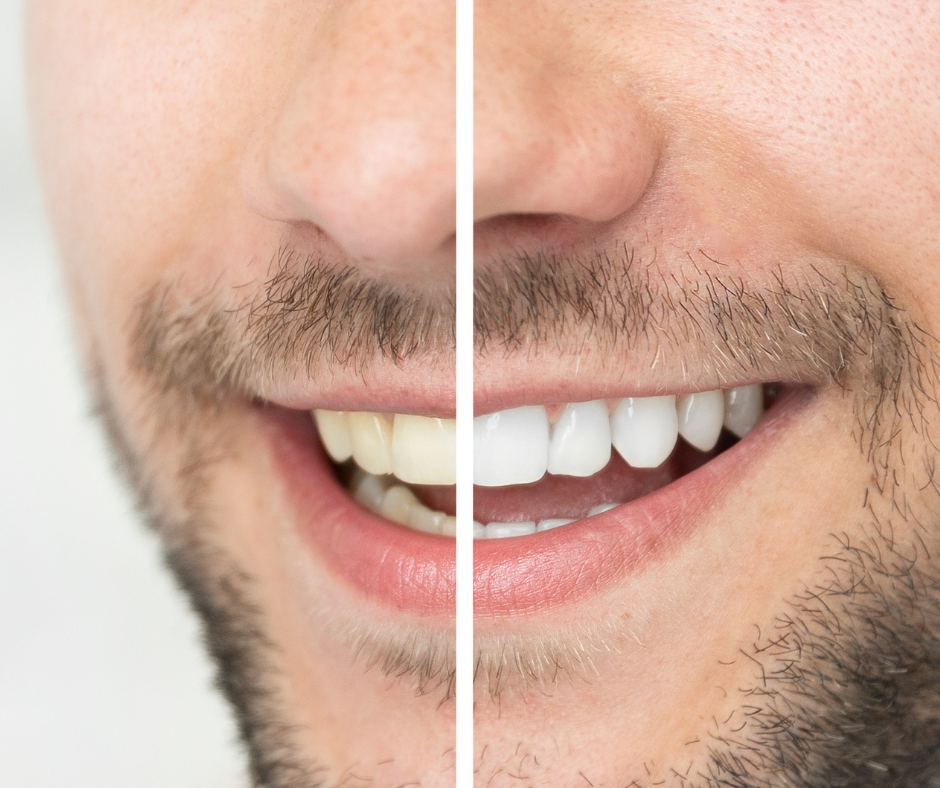 Estética do sorriso